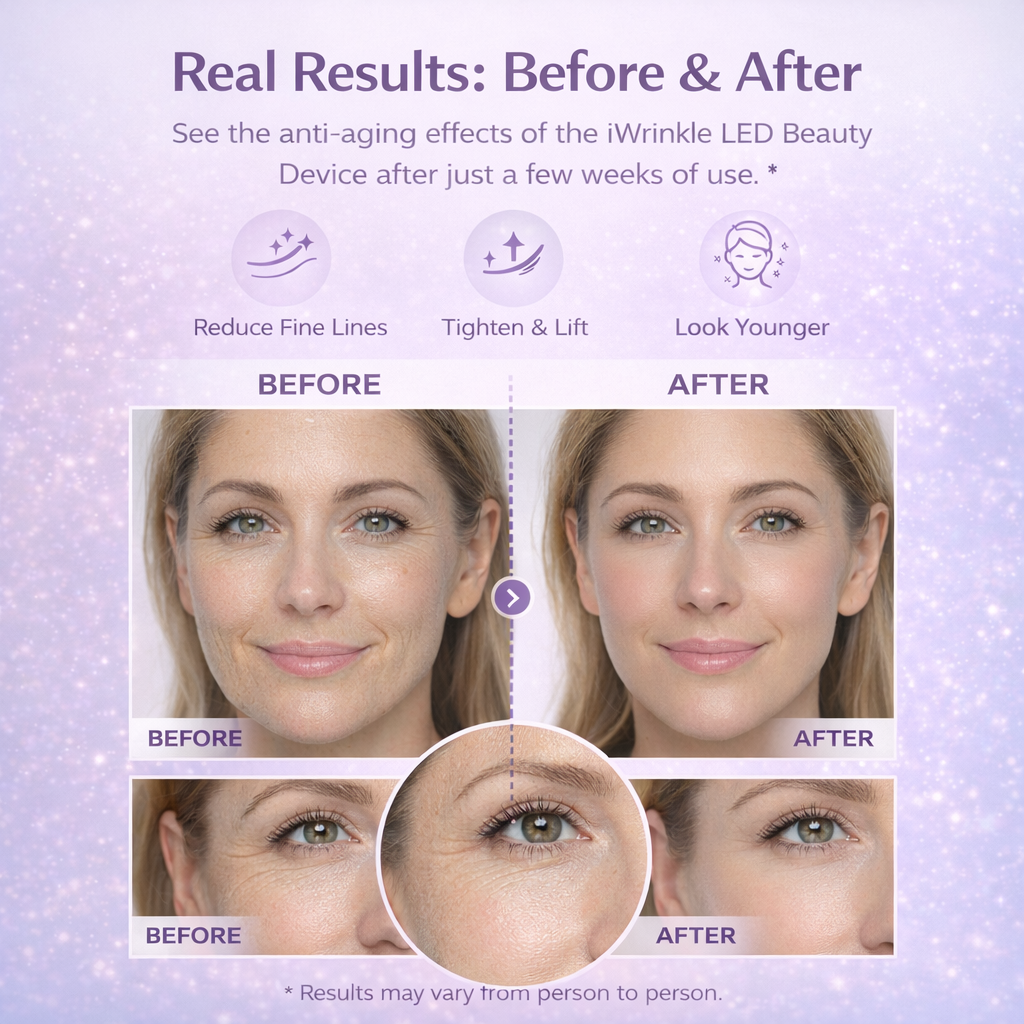 iWrinkle Remover